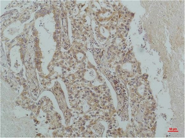 Anti-IκB β Antibody (1Z750)