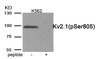 Anti-Phospho-Kv2.1 (Ser805) Polyclonal Antibody