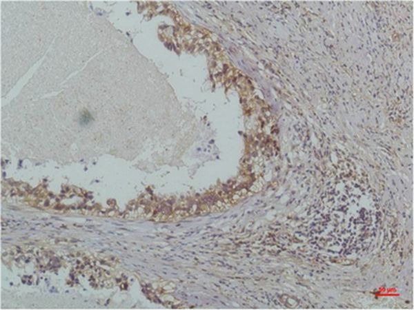 Anti-IκB β Antibody (6I903)