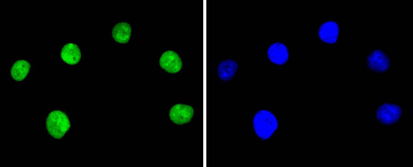 Anti-XRCC5 Antibody (9O180)