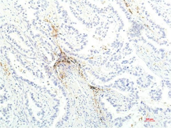 Anti-JAK1 Antibody (1F359)