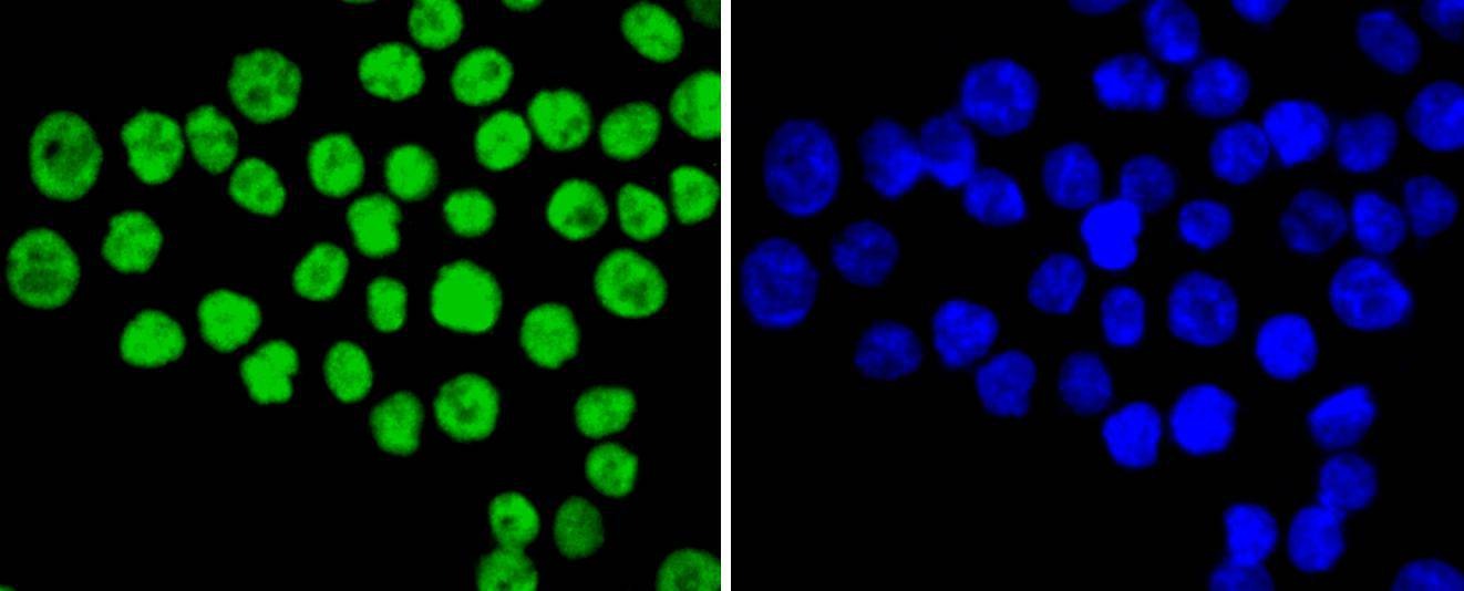 Anti-XRCC5 Antibody (9O180)
