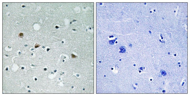 Anti-Phospho-LATS1/2 (Thr1079/1041) Polyclonal Antibody 2