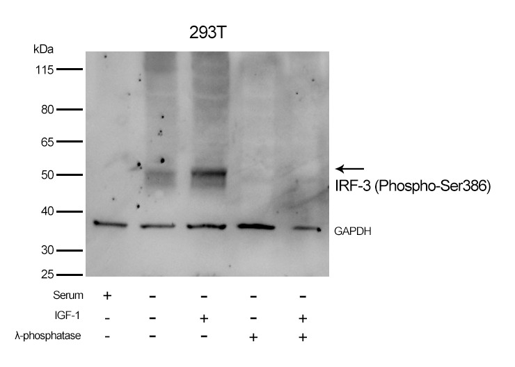 Anti-Phospho-IRF3 (Ser386) Polyclonal Antibody 2