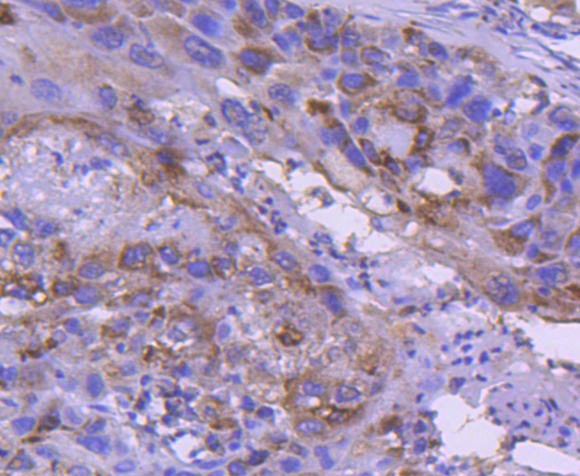 Anti-IRF5 Antibody (6F756)
