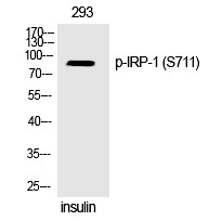 Anti-Phospho-Aconitase 1 (Ser711) Polyclonal Antibody