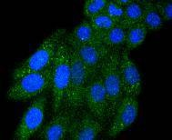 Anti-IRF5 Antibody (2A61)