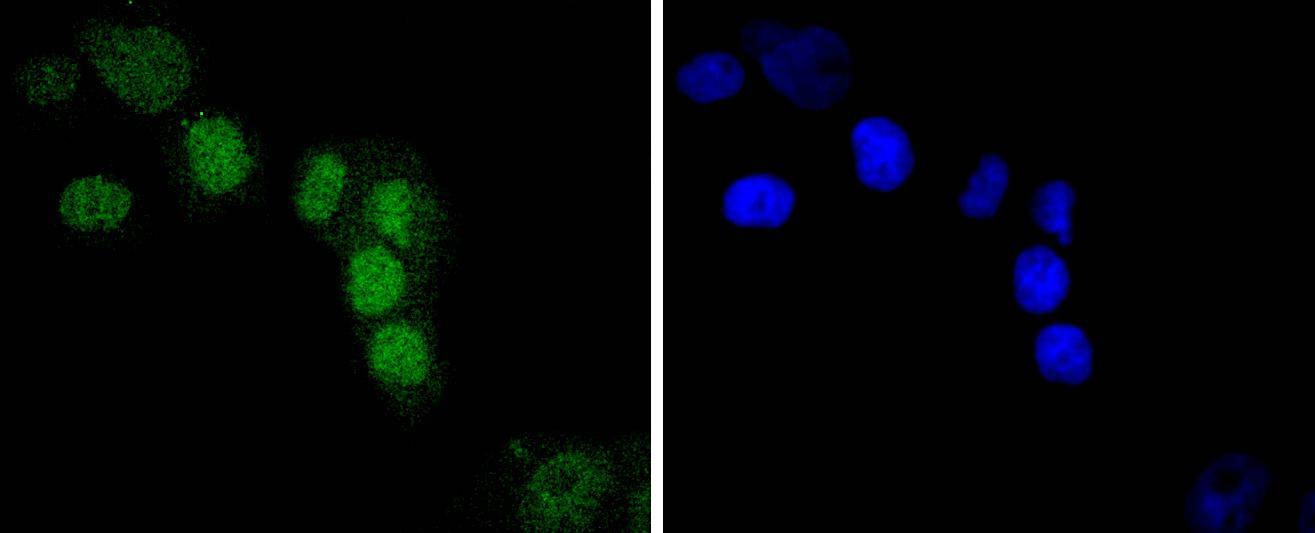 Anti-IRF2 Antibody (8B64)