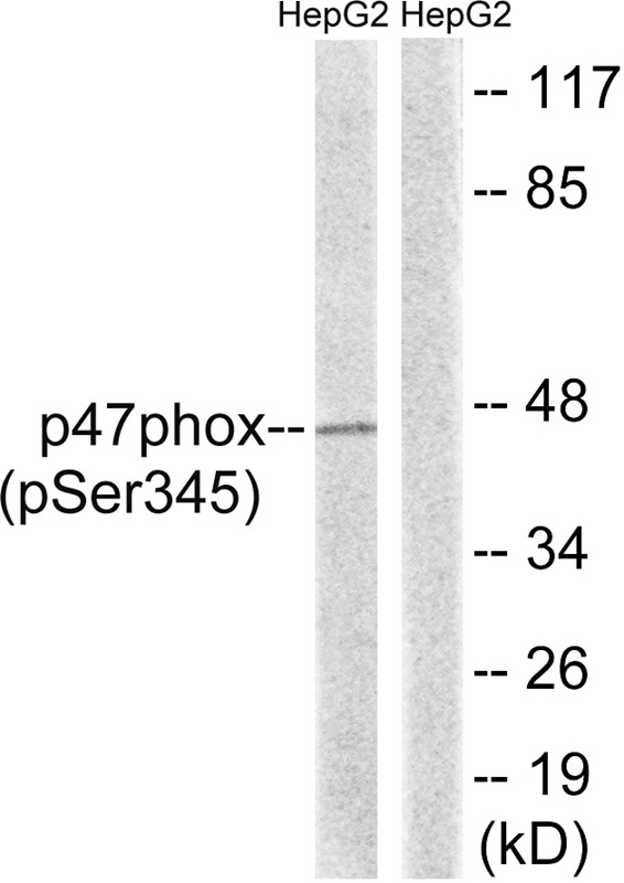 Anti-Phospho-NCF1 (Ser345) Polyclonal Antibody