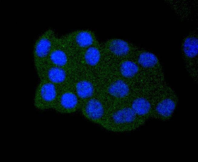 Anti-Acetyl-p53 (Lys382) Antibody (4U203)