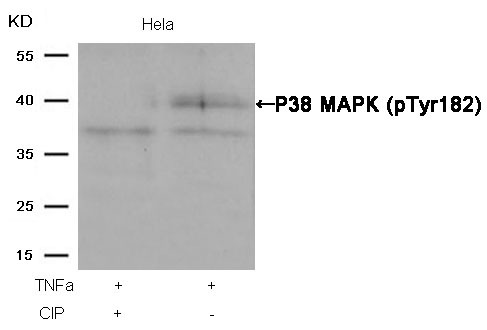 Anti-Phospho-MAPK14 (Tyr182) Polyclonal Antibody