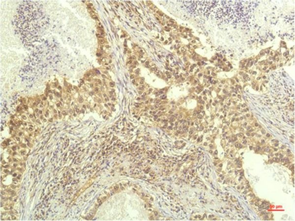 Anti-S6K1/RPS6KB1 Antibody (2X637)