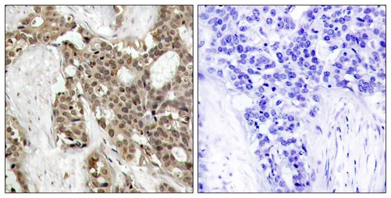 Anti-Phospho-MAPK3/ERK2 (Tyr204) Polyclonal Antibody