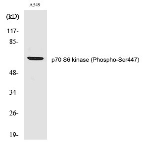 Anti-Phospho-S6K1/RPS6KB1 (Ser447) Polyclonal Antibody