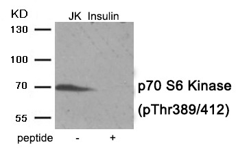 Anti-Phospho-S6K1/RPS6KB1 (Thr389/412) Polyclonal Antibody