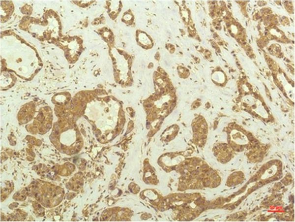 Anti-S6K1/RPS6KB1 Antibody (2X637)