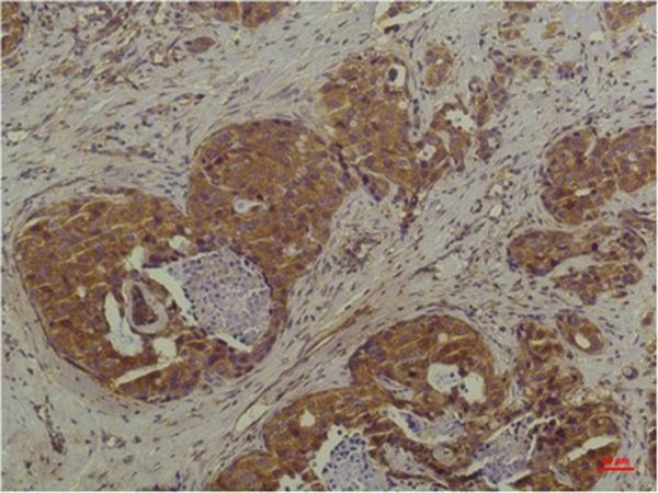 Anti-MAPK3/ERK2 Antibody (7P251)