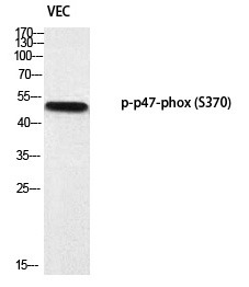 Anti-Phospho-NCF1 (Ser370) Polyclonal Antibody