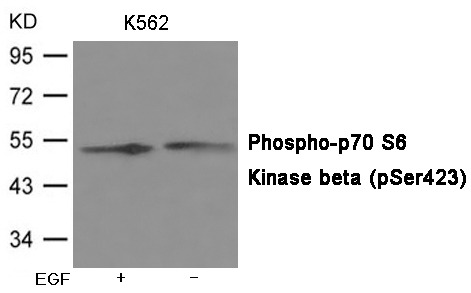Anti-Phospho-p70 S6 Kinase (Ser423) Polyclonal Antibody 2