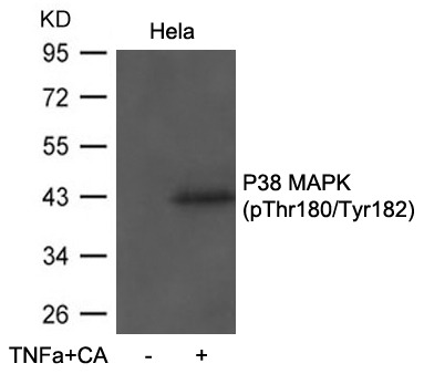 Anti-Phospho-MAPK14 (Thr180, 182) Polyclonal Antibody