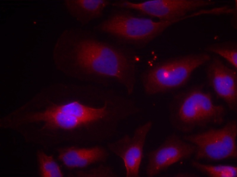 Anti-Phospho-NFkB p100 (Ser870) Polyclonal Antibody