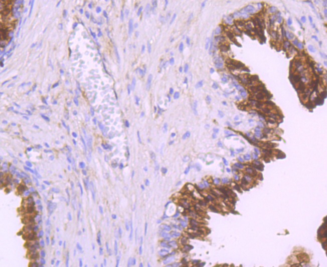 Anti-NDRG1 Antibody (7H760)