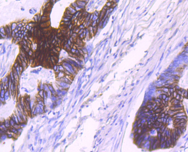 Anti-NDRG1 Antibody (7H760)