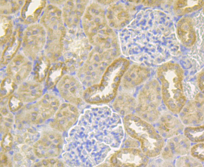 Anti-NDUFS4 Antibody (3X649)