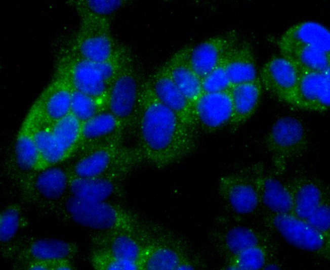 Anti-NDRG1 Antibody (7H760)