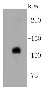 Anti-Notch 1 Antibody (6A911)