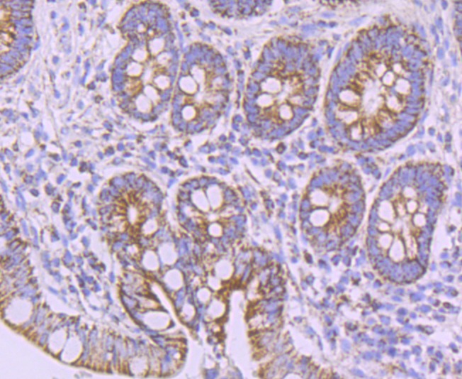 Anti-NDUFB8 Antibody (3W868)