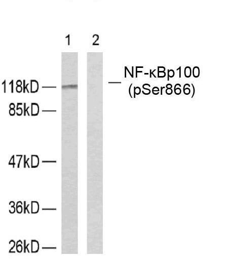 Anti-Phospho-NFkB p100 (Ser866) Polyclonal Antibody