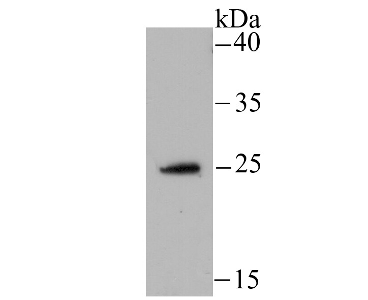 Anti-NDUFS3 Antibody (6M78)