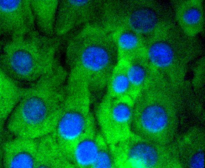 Anti-Notch 1 Antibody (6A911)