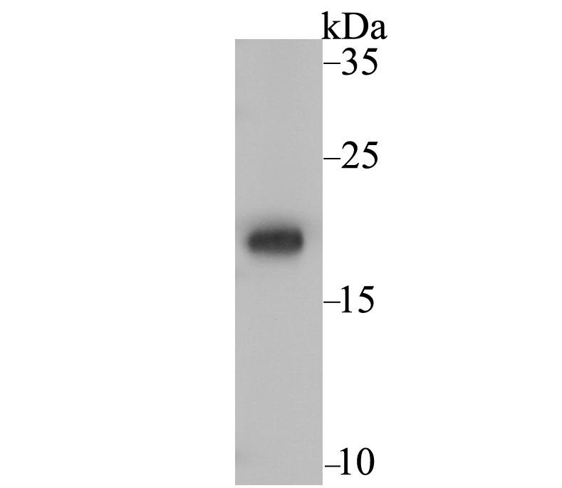 Anti-NDUFS4 Antibody (3X649)