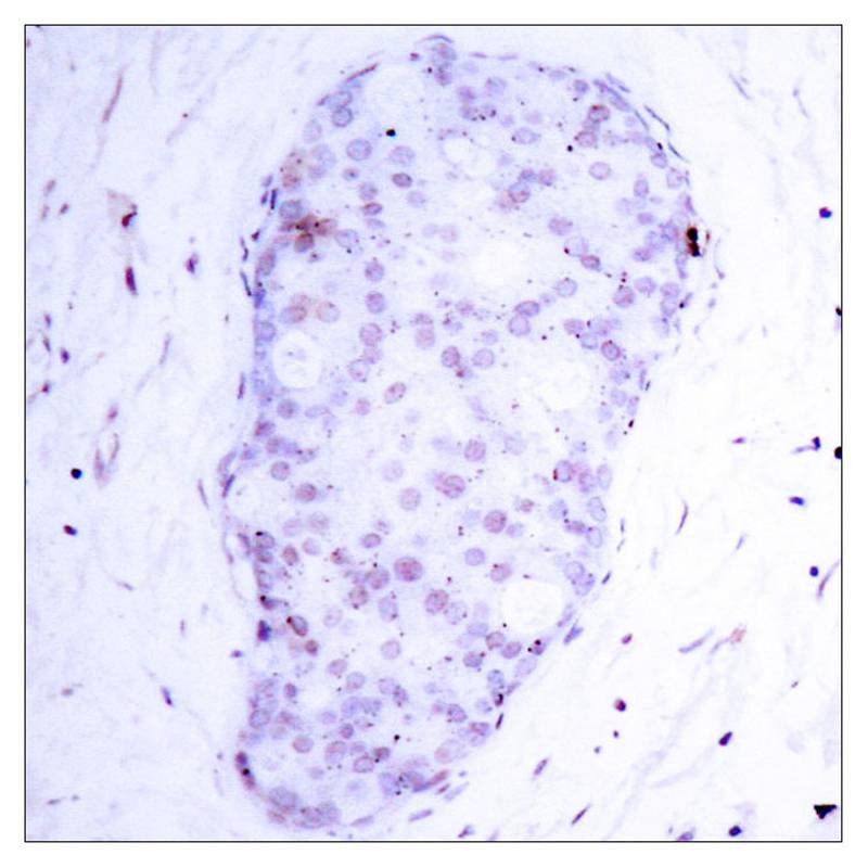 Anti-Phospho-NFKB1 (Ser907) Polyclonal Antibody