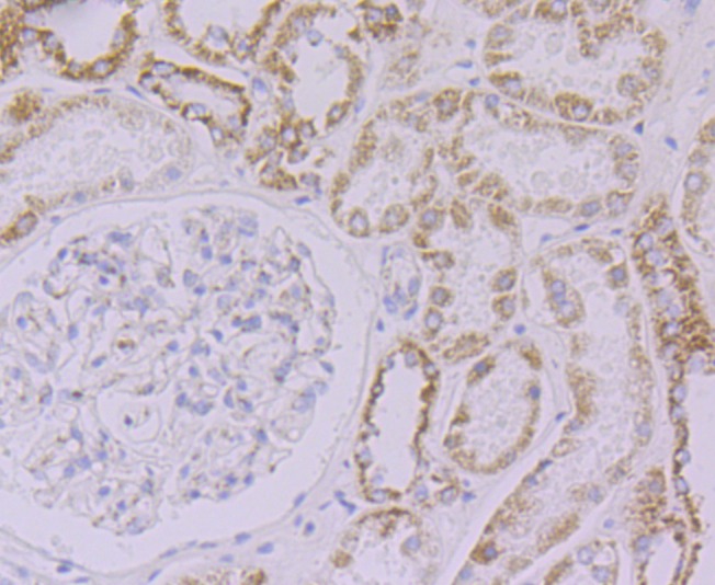 Anti-NDUFB8 Antibody (3W868)