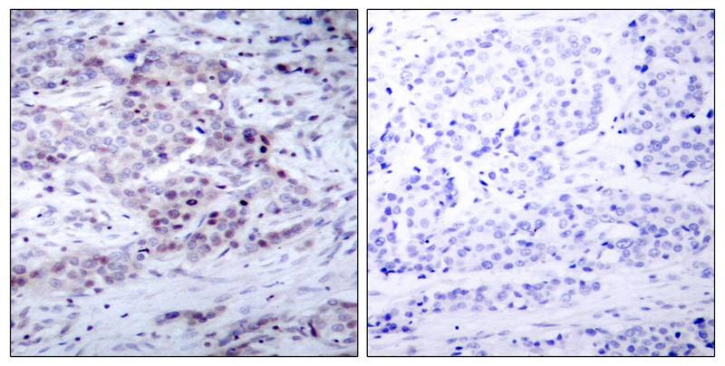 Anti-Phospho-NFkB p100 (Ser870) Polyclonal Antibody
