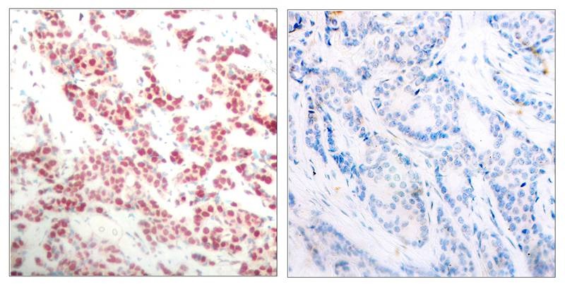 Anti-Phospho-NFkB p100 (Ser866) Polyclonal Antibody