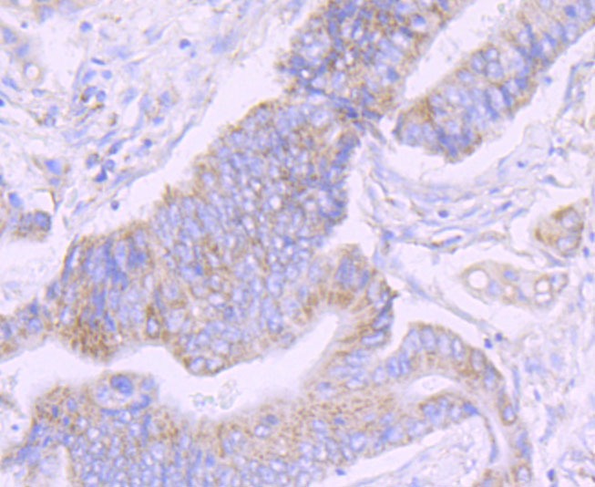 Anti-NDUFS3 Antibody (6M78)