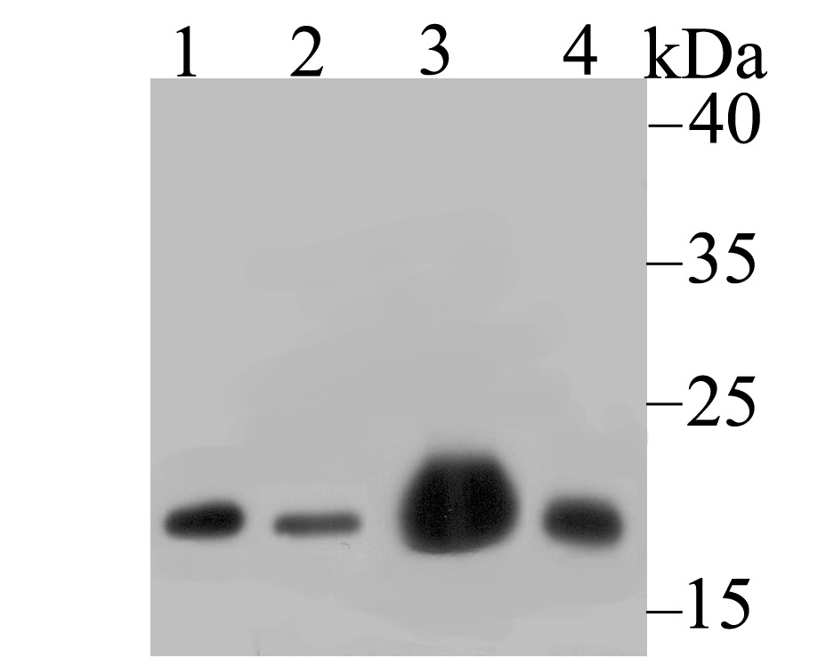 Anti-NDUFB8 Antibody (3W868)