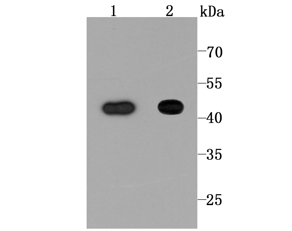 Anti-NDRG1 Antibody (7H760)