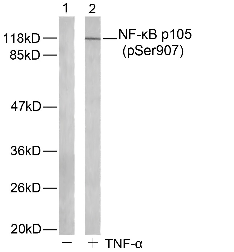 Anti-Phospho-NFKB1 (Ser907) Polyclonal Antibody