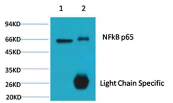 Anti-NF-kB p65 Antibody (9P885)