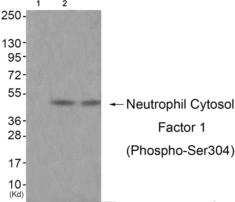 Anti-Phospho-NCF1 (Ser304) Polyclonal Antibody