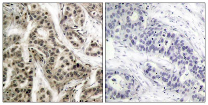 Anti-Phospho-NFKB1 (Ser337) Polyclonal Antibody 2