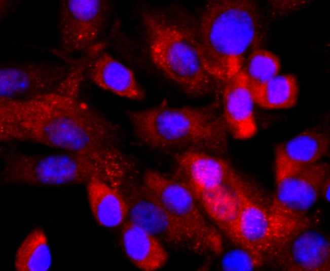 Anti-NFAT1 Antibody (4I426)