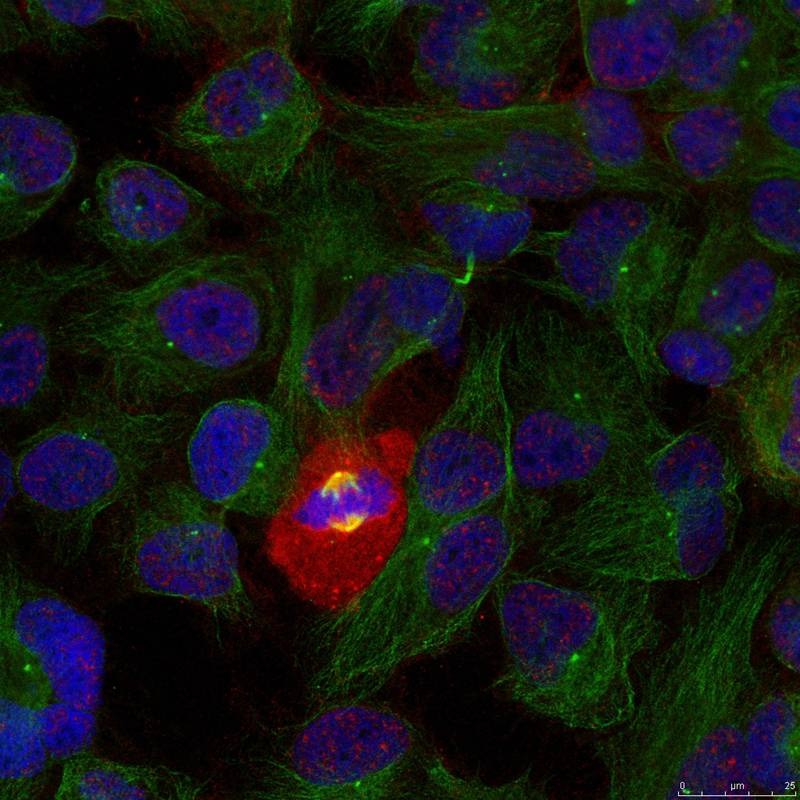 Anti-Phospho-NF-kB p65 (Thr254) Polyclonal Antibody 2