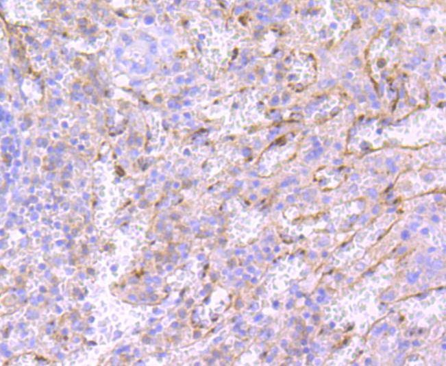 Anti-ELANE Antibody (2I484)
