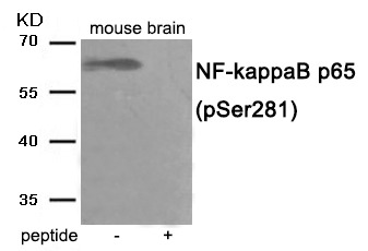 Anti-Phospho-NF-kB p65 (Ser281) Polyclonal Antibody 2